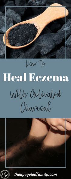 Healthy Man, Everyday Health, Many Many, Activated Charcoal, Living Tips, Natural Home Remedies, Health Remedies, Holistic Health