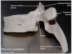 an image of a bone with labels on it