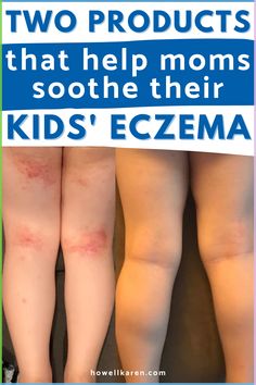 Learn what body care products moms use in their kids' eczema skincare routine. // eczema cream, eczema soap, eczema lotion bars, eczema lotion products, eczema moisturizer, eczema face, eczema in babies, eczema on face, eczema pictures children, eczema salve Heart Diet, Baking Soda Shampoo, Body Care Products, Acne Solutions, Health Planner, Diy Skincare, Best Moisturizer, Lotion Bars