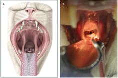 an image of the inside of a person's head and in front of another