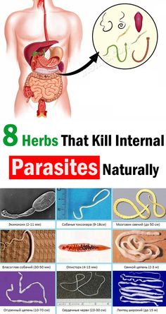 There are 8 herbs described that will help get rid of parasites. How To Remove Parasites Naturally, How To Get Rid Of Parasites, Get Rid Of Parasites Naturally, How To Get Rid Of Parasites In Humans, Parasites In Humans, Belly Cleanse, Oregano Oil Benefits, Cloves Benefits, Diatomaceous Earth Food Grade