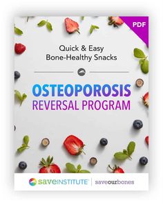 Reverse Osteoporosis, Bone Health Exercise, Dowager Hump, Calcium Foods, Osteoporosis Prevention