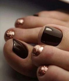 Shellac Pedicure, Fall Toe Nails, Simple Toe Nails, Pretty Fingers, Neat Nails, French Pedicure, Pedicure Ideas