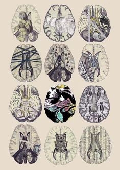 an image of many different types of brain images