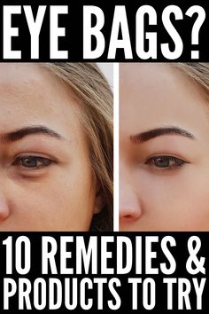 If you want to know how to get rid of eye bags, these beauty hacks will teach you how to treat and prevent puffiness, and hide dark circles fast! Undereye Bags Remedy, Get Rid Of Eye Bags, Rid Of Eye Bags, Eye Bags Makeup, Baggy Eyes, Remove Eye Bags, Hooded Eyelids, Sunken Eyes, Under Eye Makeup