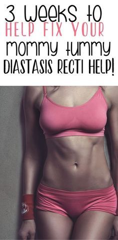 Healing Diastasis Recti, Post Baby Workout, Postpartum Workouts, Postpartum Workout, Mommy Tummy