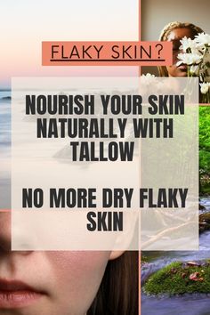 Are you struggling with flaky, dry skin? Find out how tallow can be your skin's best friend. This time-tested solution is rich in nutrients and perfect for deeply moisturizing and rejuvenating your skin. Achieve radiant, smooth skin. Dry Flaky Skin, Supple Skin, Power Of Nature, Flaky Skin, Essential Nutrients, Smooth Skin, Good Skin