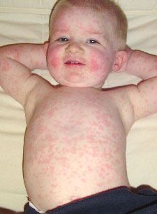 a baby laying on top of a bed covered in ectomid skin and looking at the camera