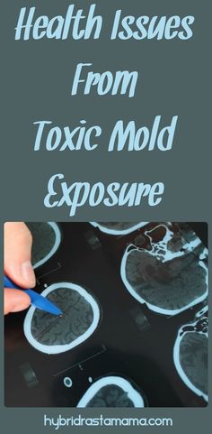 Mold in my brain? Yes, its true. This post takes a look at mold related health issues in children, adults, and pets from a survivor of toxic mold. From HybridRastaMama.com #toxicmold #naturalhealth  via @hybridrastamama Children Health, Body Hacks, Mold Remover, Childrens Health