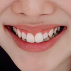 a close up of a woman's smile with white teeth