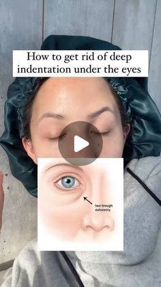 Getting My Eyes Checked Cause, Around Eyes Skin Care, Wrinkle Under Eyes Remedies, How To Get Rid Of Sunken Under Eyes, Smooth Under Eyes, Under Eye Hollows Remedies, How To Get Rid Of Lines Under Eyes, Eye Bags Remedy, Under Eye Fine Lines