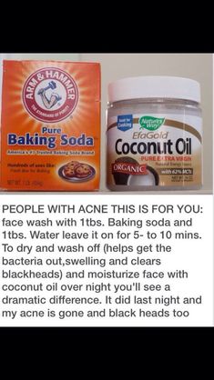 Baking Soda Coconut Oil, Acne Help, Diy Acne, Homemade Oil, Home Remedies For Acne, Acne Remedies, Skin Remedies