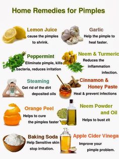 Acne Recipes, Remedies For Pimples, Home Remedies For Pimples, Get Rid Of Pimples, Rid Of Pimples, Acne Overnight, Pimples Remedies