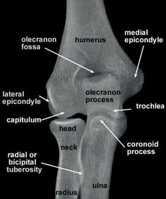 Elbow Xray Anatomy, Elbow Xray, Medial Epicondyle, Elbow Anatomy, Anatomy Lab, Radiologic Technologist