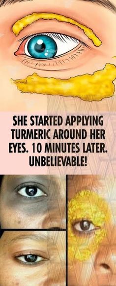 Turmeric is a plant that became famous for its detoxifying properties in the last decade. You can either eat it or use it as an ingredient in many cre Whiten Underarms Fast, How To Whiten Underarms, Health And Fitness Articles, Cold Home Remedies, Oil Benefits, Health Motivation, Health Lifestyle, Wellness Tips, Health Remedies