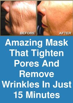 Skin Care Wrinkles, Face Wrinkles, Anti Aging Facial, Mental Training, Skin Remedies, Tighten Pores, Skin Care Cream, Younger Looking Skin, Wrinkle Remover