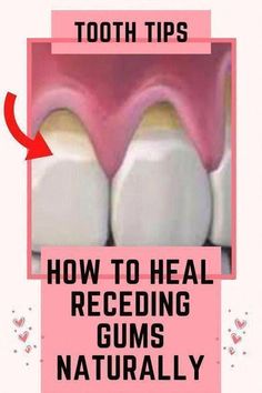 essential oils for dental care Heal Receding Gums Naturally, Vitamin For Teeth And Gums, How To Regrow Gums Around The Teeth, Teeth Health Heal Cavities, Remineralize Teeth Heal Cavities, Homemade Mouthwash, Teeth Whitening Diy, Natural Toothpaste, Receding Gums