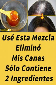 Natural Remedies For Migraines, Honey Brown Hair, Natural Healing Remedies, Hair Tips Video, Hair And Beauty Salon