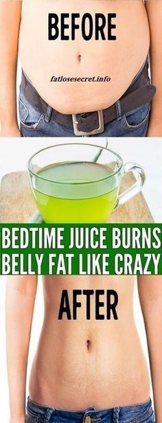 ACV (Apple cider vinegar) drink is one of the best drinks for weight loss that can help you lose about 20 pounds in a month, YES! You heard me correctly.This drink helped me a lot on my weight… Belly Fat Burner Workout, Burner Workout, Fat Burner Workout, Water Challenge, Belly Fat Drinks, Belly Fat Burner Drink, Belly Fat Burner, Fat Loss Drinks, Best Detox