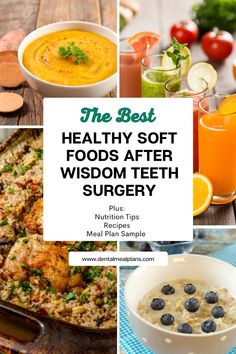 Learn what foods to enjoy after wisdom teeth surgery that may help with healing. Plus get recipss and a sample meal plan all on the blog Wisdom Teeth Food Meals, Post Wisdom Teeth Food, Healthy Soft Foods, Wisdom Teeth Removal Food, Eating After Tooth Extraction, Food After Tooth Extraction, Wisdom Teeth Food