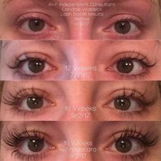 Long Lashes Mascara, Lash Growth Serum, Lashes And Brows, Lash Growth, Lash Boost, Keep Growing, Eyelash Serum, Lash Serum, Growth Serum