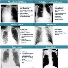 Radiography Student, Radiology Schools, Medical Radiography, Interventional Radiology, Radiology Tech