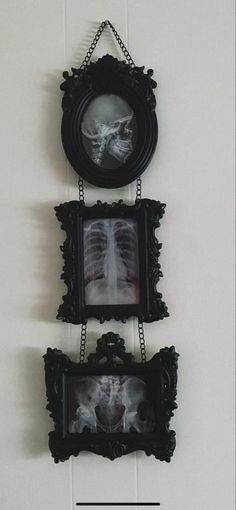 two framed pictures hang on the wall next to each other, with an x - ray in between them