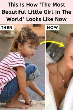 Thylane Blondeau, Style Mistakes, Loreal Paris, Plastic Surgery, Funny Facts, Fall Outfits, Most Beautiful, Hollywood, Celebrities