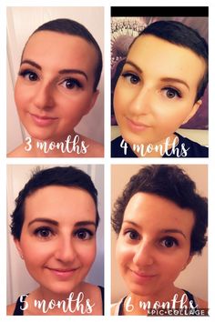 Growing Hair After Chemo, Hair Growth Post Chemo, Chemo Curls, Hair Growth After Chemo, Growing Out Hair, Chemo Care, Chemo Hair, Let It Grow, Help Hair Grow