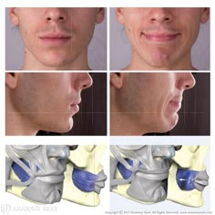 four different views of a man's face and neck, including the upper half of his head