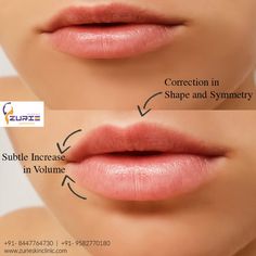 Lip Filler Bottom Lip Bigger, Lip Goals, Lip Job, Brow Lifting, Russian Lips, Plumper Lips, Lipsense Combos