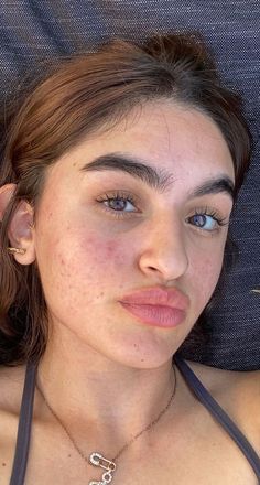 Estilo Kylie Jenner, Bare Face, Face Acne, Raw Beauty