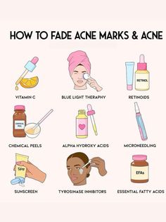 #skincare #skin #acne #acnetreatment #aesthetic #beautyskincare #beautycare #tips #treatment #face Clean Girl With Acne, Cystic Acne Remedies, Fade Acne Marks, Premature Wrinkles, How To Fade, Esthetician Marketing, Acne Skincare