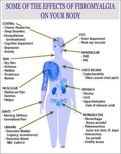 Pain Chest Pain, New Energy, Chronic Pain, Back Pain