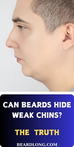 Can a beard really hide a weak chin? Absolutely! We reveal the secret beard style that helps create the illusion of a stronger jawline. Find out how to shape and style your beard to enhance your facial structure and make that weak chin disappear. Don’t miss this game-changing grooming tip! #BeardHacks #WeakChinFix #JawlineGoals #BeardStyles #MensGroomingTips Weak Chin, Jawline Goals, Facial Structure