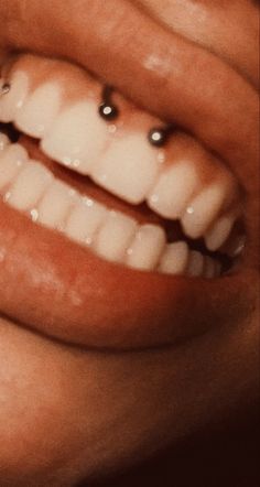 a woman's smile with braces and piercings on her teeth is shown