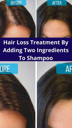 Hair Loss Treatment By Adding Two Ingredients To Shampoo Home Remedies For Hair Growth, Remedies For Hair Growth, Shampoo For Thinning Hair, Hair Growing Tips