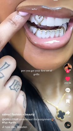 Silver Open Face Grillz, Sliver Grill Teeth, Women With Grills, Bottom Teeth Grills, Female Grills, Gap Grillz, Mouth Grillz, Open Face Grillz