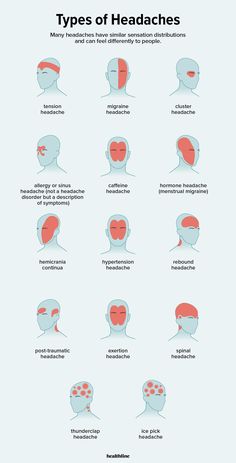 Types of Headaches: Symptoms, Causes, Treatments, and More Headache Types, Medical Knowledge, Health Info, Health And Beauty Tips, Health Facts, Home Health, Useful Life Hacks