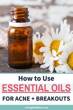 Essential Oils For Zits, Oils For Acne, Clearing Acne, Do Terra, Pimples Remedies, Yl Oils, Natural Acne Remedies, Acne Oil