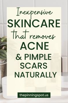 Want an Inexpensive acne skincare routine to remove acne scarring and pimple scars naturally. well, in this post, I show you how I was able to clear acne and get rid of the scars from acne on oily skin using the most inexpensive skincare routine. Youll find out how I was able to remove acne scarring and pimple scarring naturally using an inexpensive skincare routine. Youll learn how to take care of your skin naturally, how to get rid of pimple scars & how to get rid of scars from acne. Inexpensive Skincare Routine, Get Rid Of Scars, Getting Rid Of Scars, Skincare Habits, Growing Healthy Hair, Pimple Scars, Acne Scarring, Pimples Remedies, Oily Skin Acne