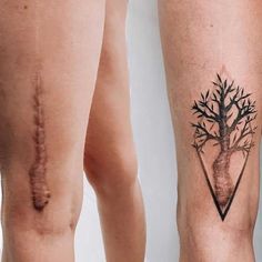 two tattoos on the legs of people who are both showing their scarp and scars