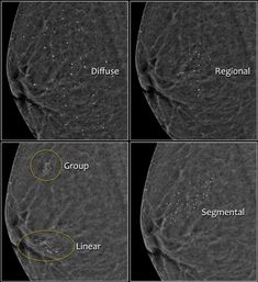 four different views of the same area in an image, each with different areas labeled