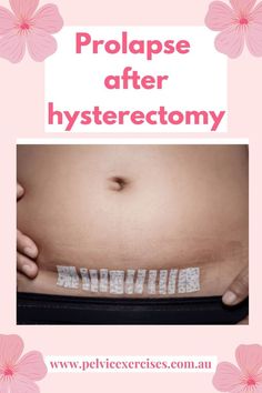 Prolapse after hysterectomy Post Surgery Care Package, Pelvic Exercises, Surgery Care Package, Healthy Stomach, Preparing For Surgery, Menstrual Health, Healthy Morning Routine, Surgery Recovery, Daily Health Tips