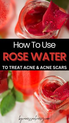 How to get rid of Acne scars Once for all Acne Face Mask Homemade, Rose Water For Skin, Cystic Acne Remedies, Mask For Oily Skin, Skincare Hacks, Mask For Dry Skin, Shaving Tips, Get Rid Of Acne, Rid Of Acne