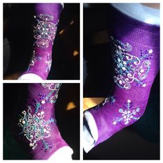 Decorated ankle cast with Bling..Snowflakes❄️ Let it Go! Crutch Decorations, Hippy Baby, Leg Cast, Cast Art