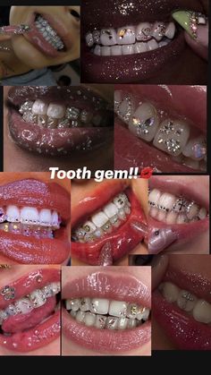 many different pictures of teeth with braces and diamonds on them, all showing the same amount