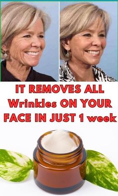 IT REMOVES ALL WRINKLES ON YOUR FACE IN JUST 1 WEEK Rid Wrinkles, Natural Wrinkle Remedies, Skin Transformation, Homemade Wrinkle Cream, Wrinkle Remedies, Erase Wrinkles, Neck Wrinkles, Eternal Youth