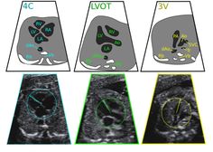 an image of different types of mri images