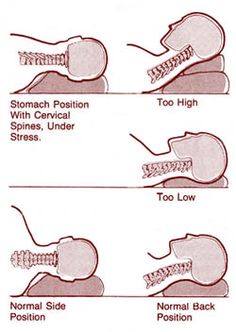 Sleep positions for best sleep and happy body! Neck Excercise, Posture Fix, Sleep Posture, Sleep Positions, Neck Problems, Best Sleep, Bad Posture